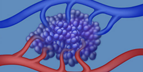 aggeiaki_displasia.jpg
